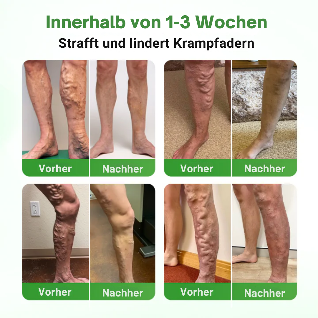 VienHeal™ | Mikronadel-Pflaster