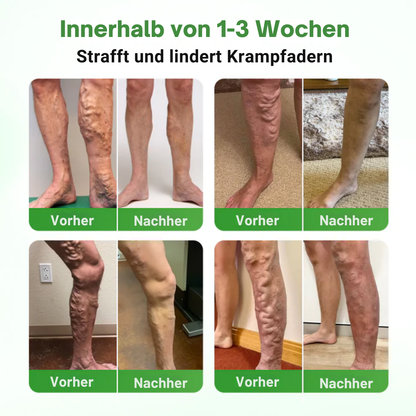 VienHeal™ | Mikronadel-Pflaster