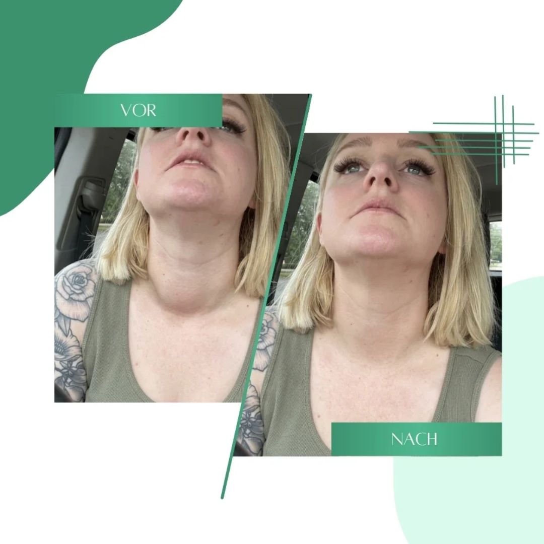 ThyroWell™  | Unterstützung der Schilddrüse