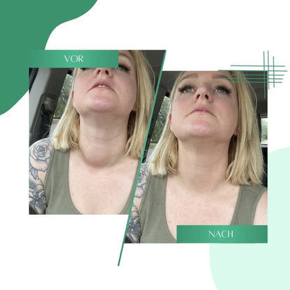 ThyroWell™  | Unterstützung der Schilddrüse