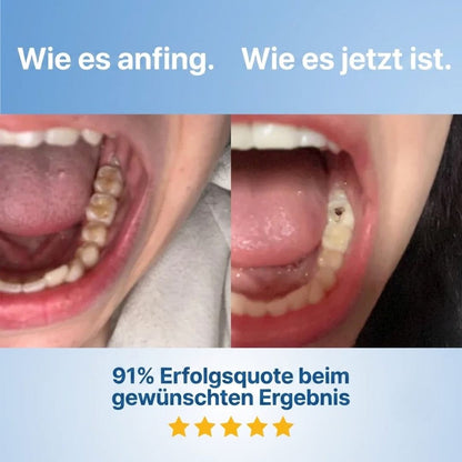 GumRevive™ | Zahnschutz-Schild