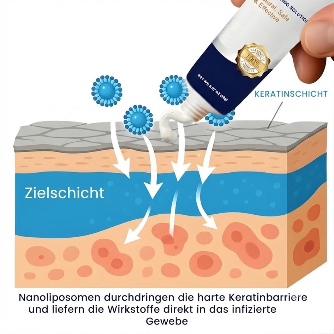 SureClear™  | Genitalwarzen-Entfernungscreme