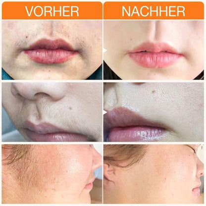 JoyPretty™ | Gesichts-Haarentfernungscreme