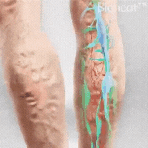 CalmLeg™ | Professionelle Bein-Circulationscreme
