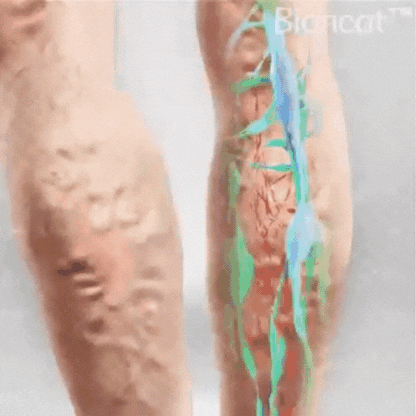 CalmLeg™ | Professionelle Bein-Circulationscreme