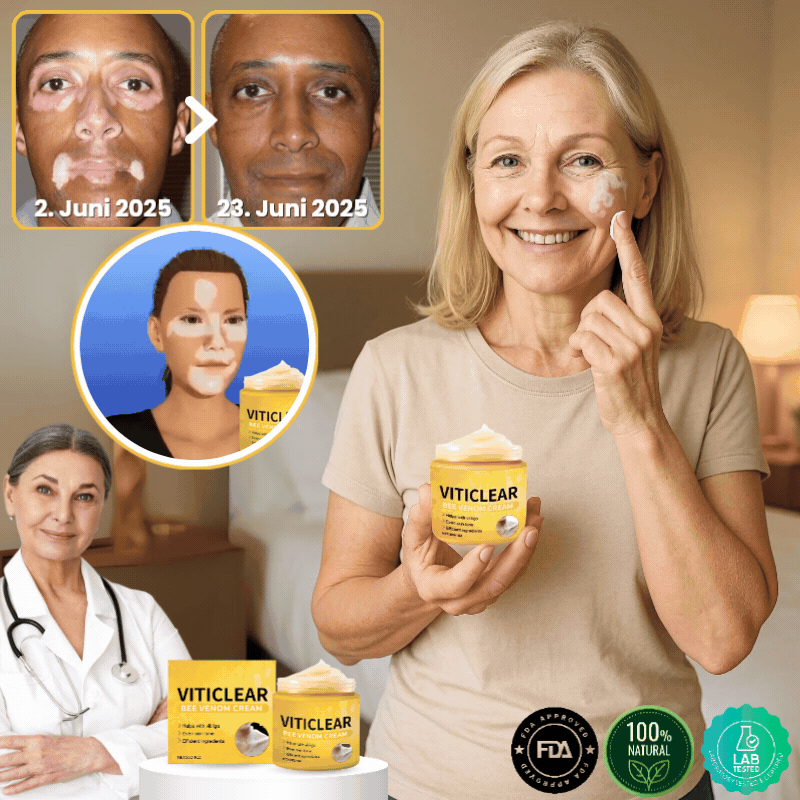 VitiClear™ | Bienengift Vitiligo Creme