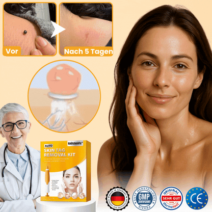 KnötchenFix™ | Hautanhängsel-Entferner Set