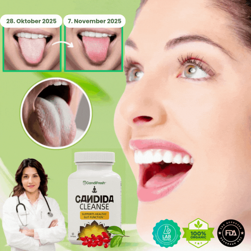 CandiFresh™ | Candida-Cleanse-Kapseln gegen weißen Zungenbelag