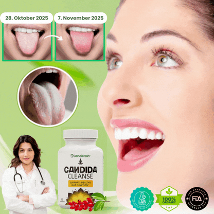 CandiFresh™ | Candida-Cleanse-Kapseln gegen weißen Zungenbelag