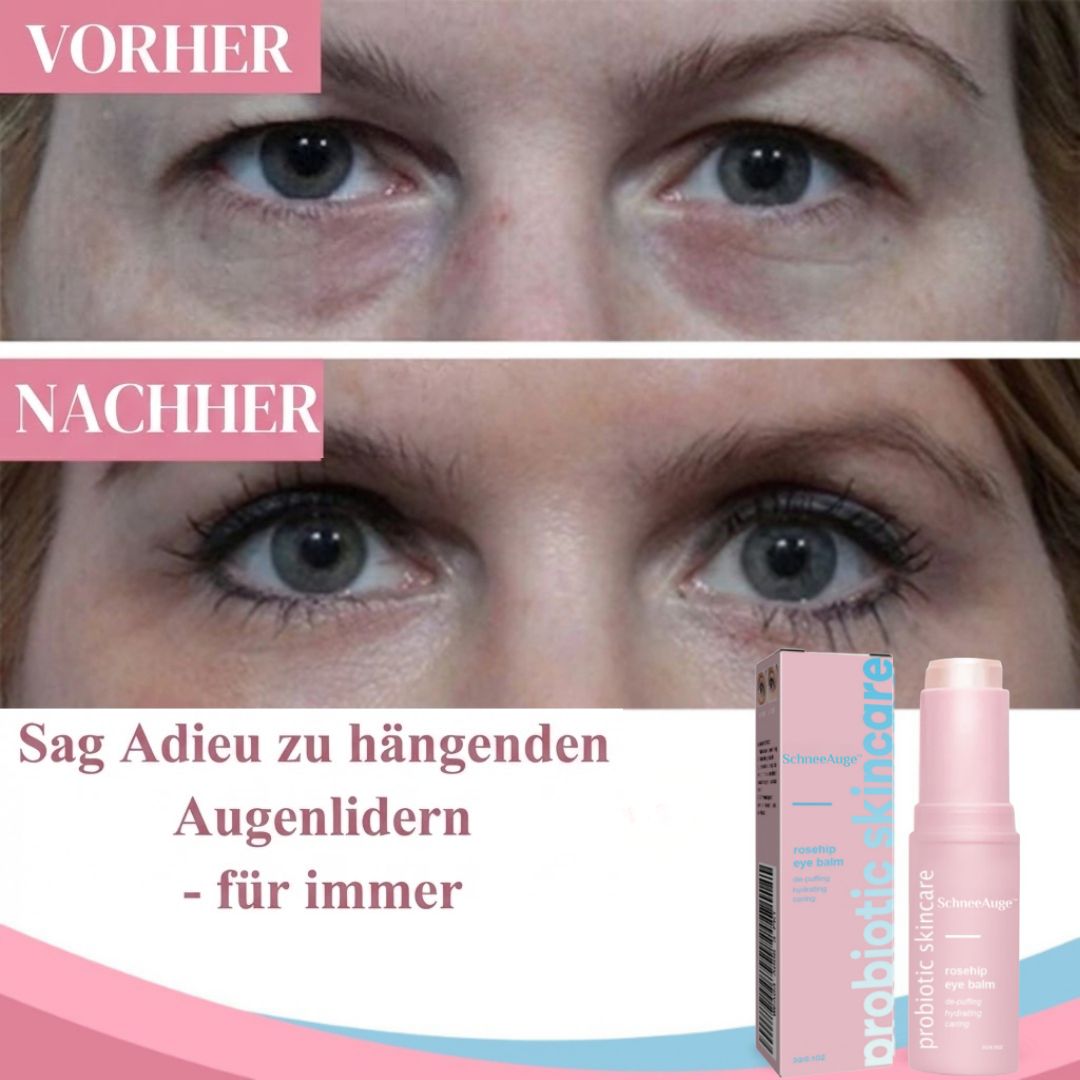 SchneeAuge™ | Augenbalsam