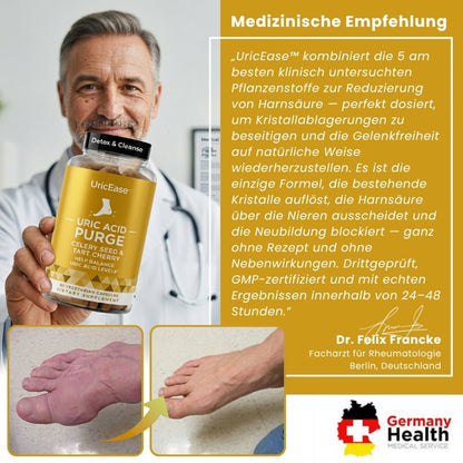 UricEase™ | Formel zum Schutz vor Harnsäure