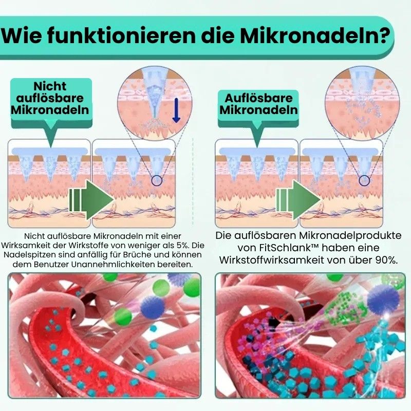 FitSchlank™ | GLP-1 Nano Mikronadelpflaster