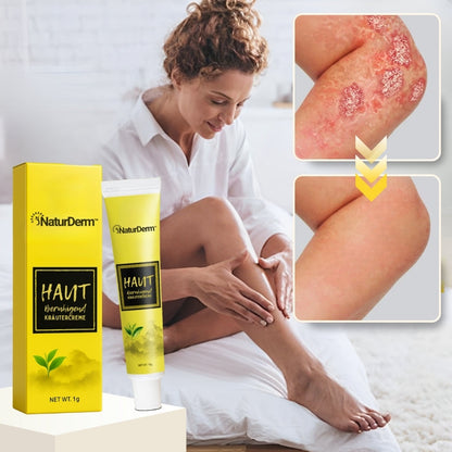 NaturDerm™ | Haut Beruhigende Kräutersalbe