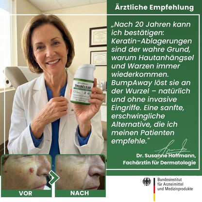 BumpAway™ | Botanische Warzen-Creme