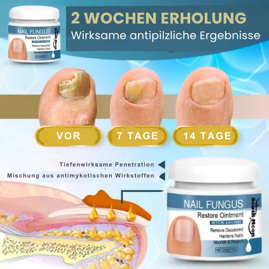 Nailixir™ | Nagelpilzbehandlungssalbe