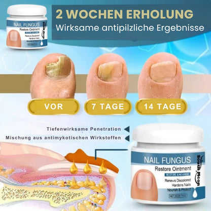 Nailixir™ | Nagelpilzbehandlungssalbe