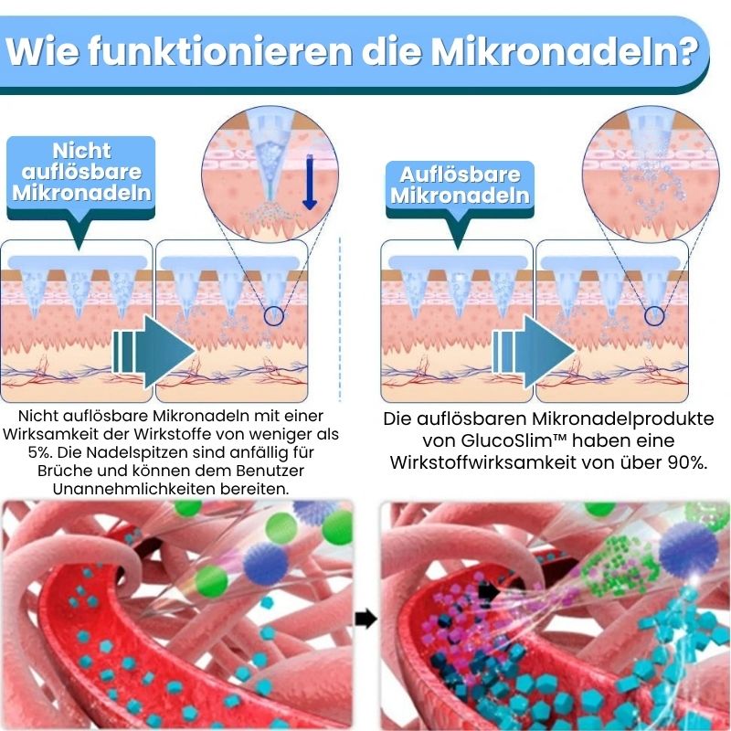 GlucoSlim™ | Nano-Mikronadel-Pflaster