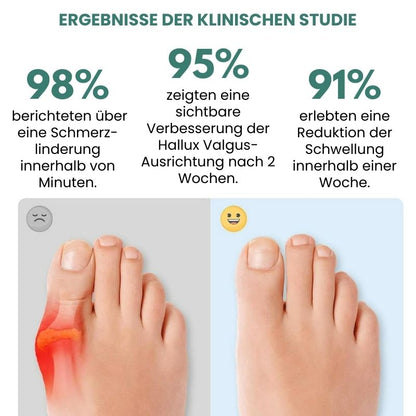 OrthoAlign™ | Sichtbare Korrektur bei Hallux Valgus bereits ab der ersten Anwendung!