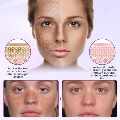 GlowGenix™ | Niacinamid Aufhellendes Sommersprossen Serum