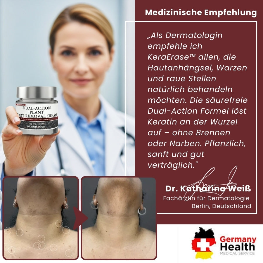 KeraErase™ | Pflanzliche Warzenentfernungscreme mit Doppelwirkung