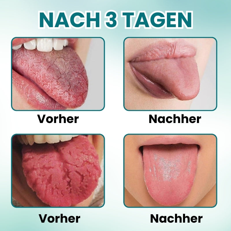 FrischeZunge™ | Frischer Atem 24/7