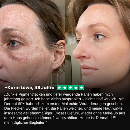 DermaLift™ | Straffender Talg-Honig-Balsam gegen Falten