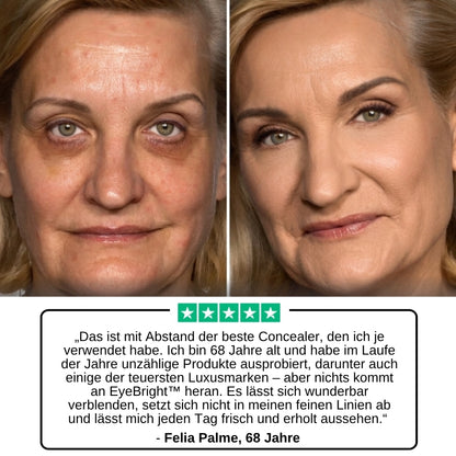 EyeBright™ | CC-Creme-Concealer
