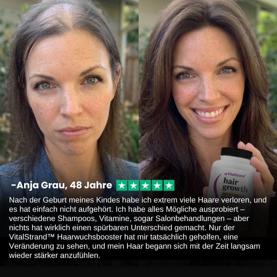 VitalStrand™ | Haarwuchsbooster-Kapsel