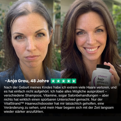 VitalStrand™ | Haarwuchsbooster-Kapsel