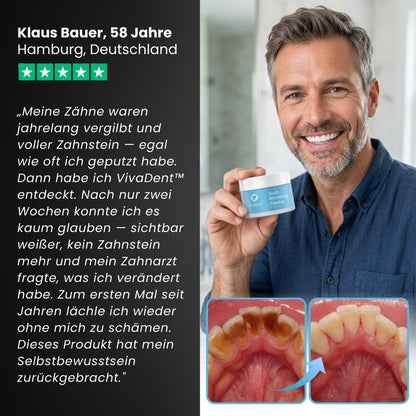 VivaDent™ | Zahnreparaturpulver