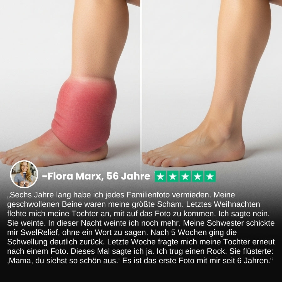 SwelRelief™ | Creme zur Linderung von Beinödemen
