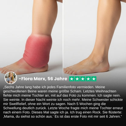 SwelRelief™ | Creme zur Linderung von Beinödemen