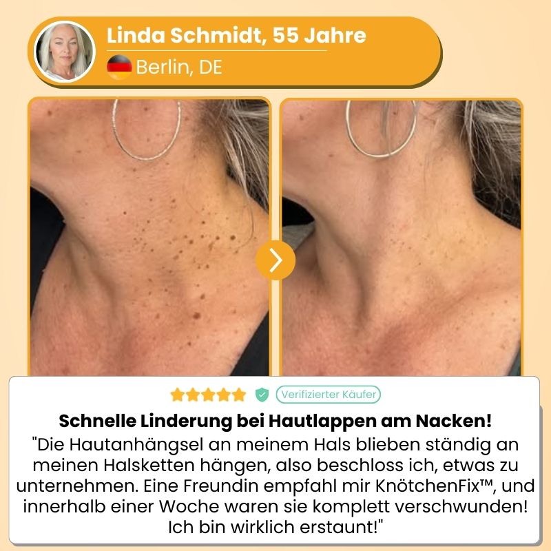 KnötchenFix™ | Hautanhängsel-Entferner Set