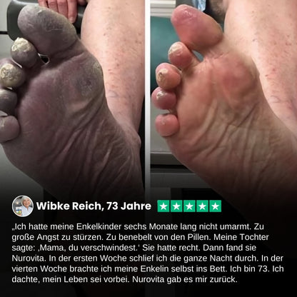 Nurovita™  | Natürlicher Creme für Neuropathie-Komfort