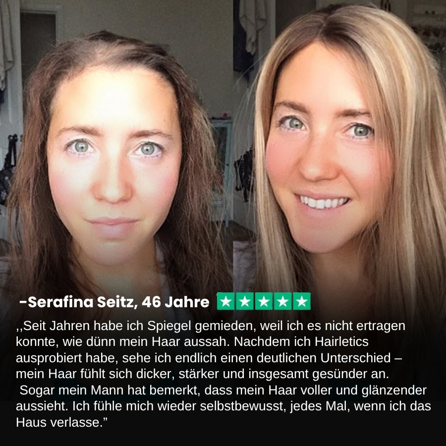 Hairletics™ | Das 60-Sekunden-Spray, das Ihren Scheitel füllt und das Haarvolumen direkt an der Wurzel stärkt!