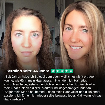 Hairletics™ | Das 60-Sekunden-Spray, das Ihren Scheitel füllt und das Haarvolumen direkt an der Wurzel stärkt!