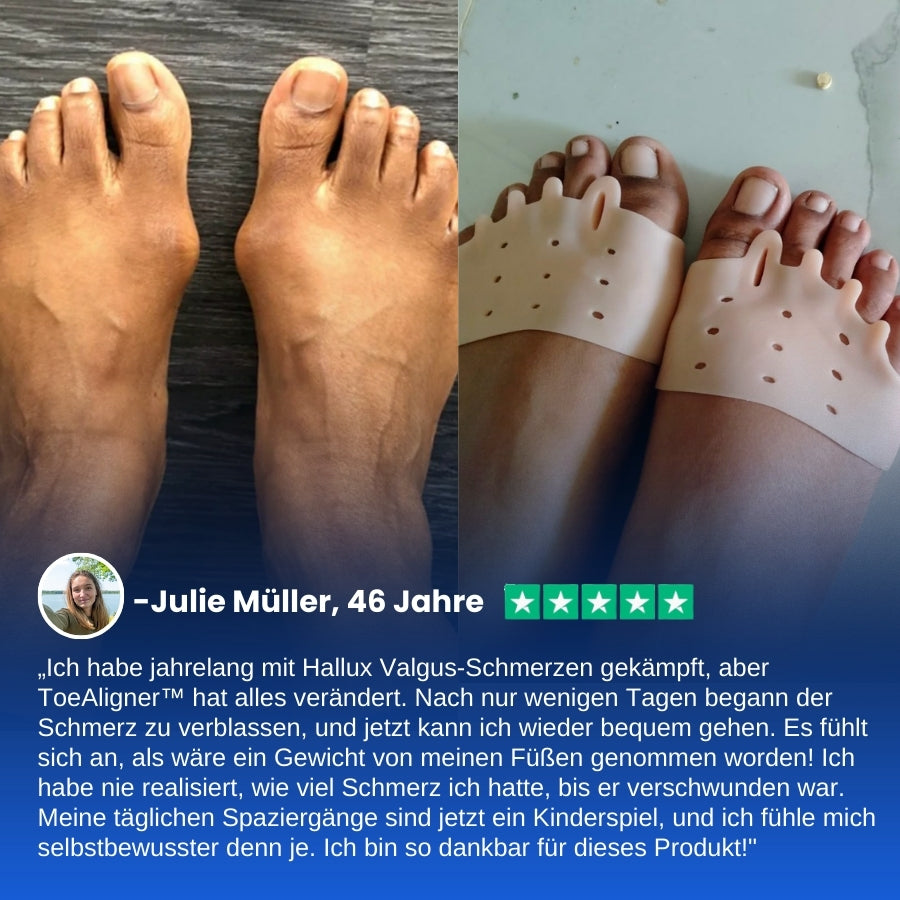 ToeAligner™ | Hallux Valgus Therapeutische Einlegesohlen
