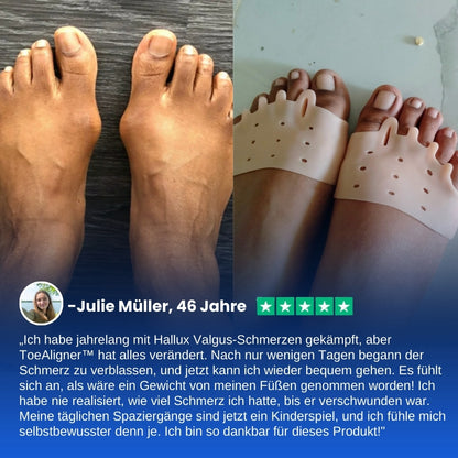 ToeAligner™ | Hallux Valgus Therapeutische Einlegesohlen