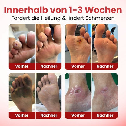 VitaGluco™ | Diabetische Hautreparaturcreme
