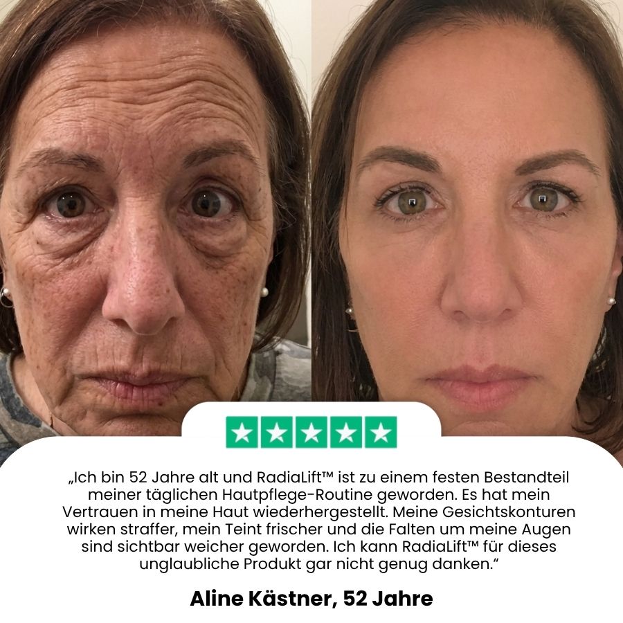 RadiaLift™ | Anti-Aging Roll-on-Essenz-Booster