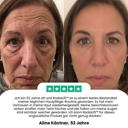 RadiaLift™ | Anti-Aging Roll-on-Essenz-Booster