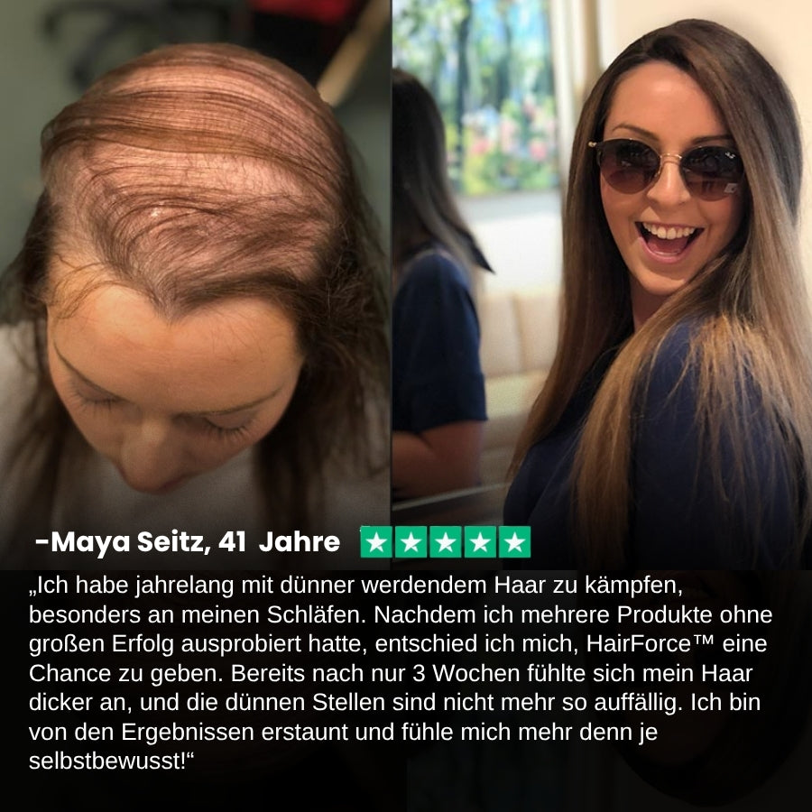 HairForce™ | Verabschieden Sie sich von Haarausfall und erhalten Sie in nur 2 Wochen volleres Haar!