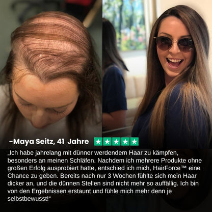 HairForce™ | Verabschieden Sie sich von Haarausfall und erhalten Sie in nur 2 Wochen volleres Haar!