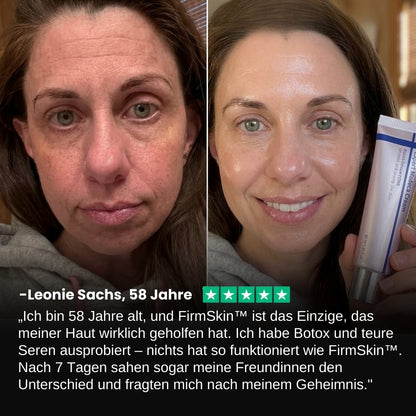 FirmSkin™ | PDRN Active Renew Creme