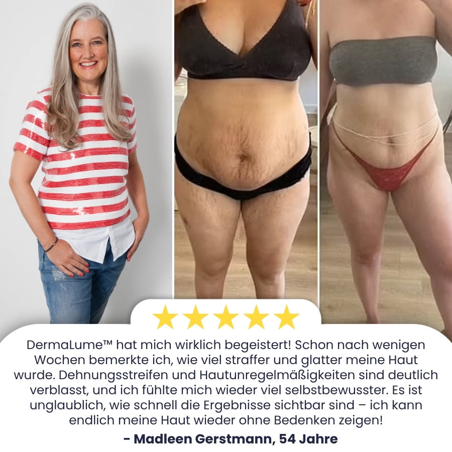 DermaLume™ | Retinol Anti-Aging Körpercreme