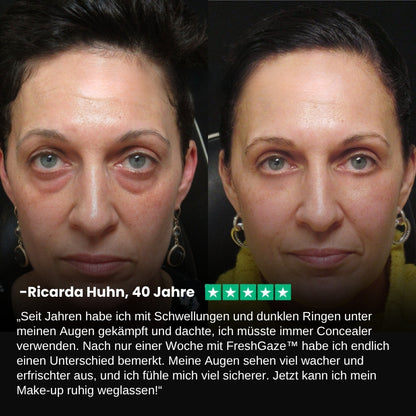 FreshGaze™ | Augenpflegebalsam