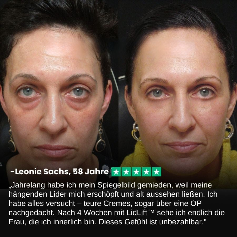 LidLift™ | Augenlid-Straffungscreme