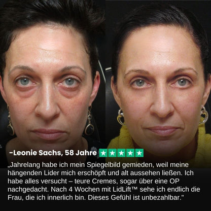 LidLift™ | Augenlid-Straffungscreme