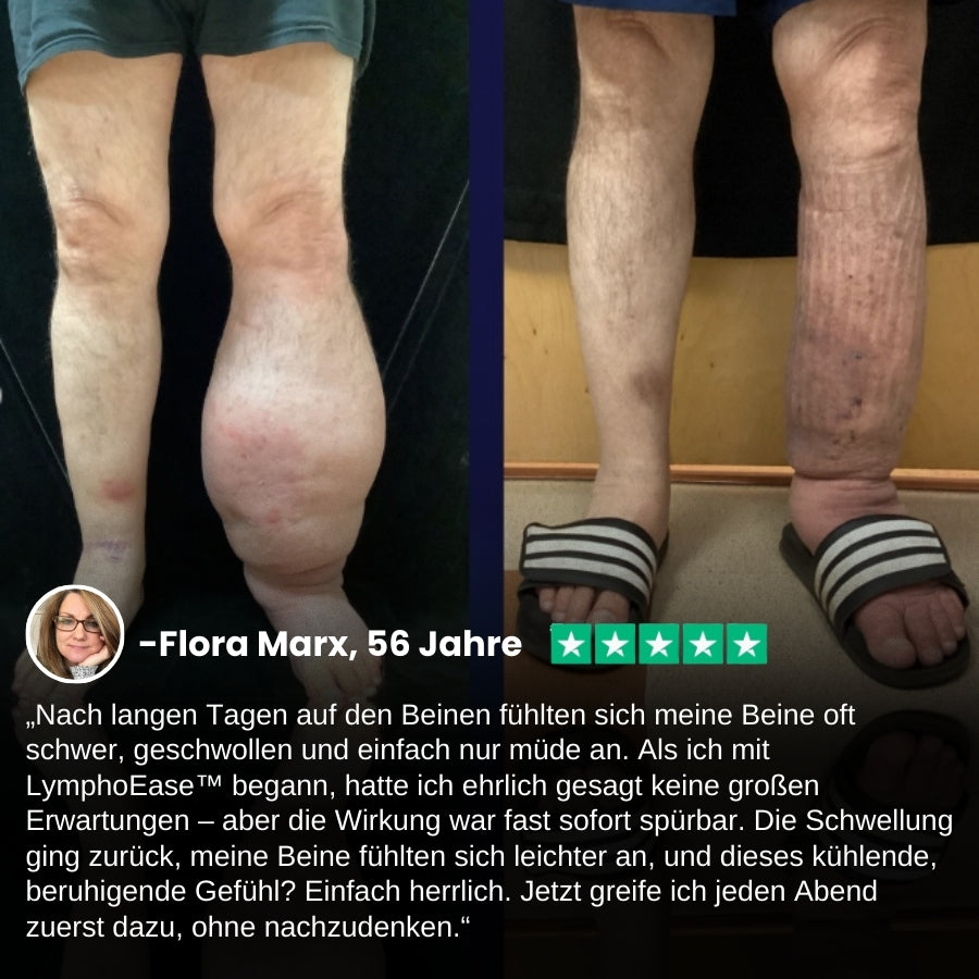 LymphoEase™ | Fühlen Sie sich in nur 14 Tagen leicht, entspannt und frei von Schwellungen