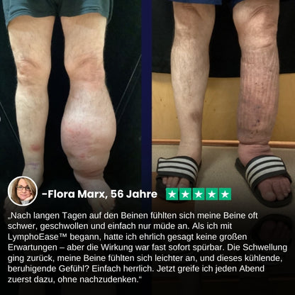 LymphoEase™ | Fühlen Sie sich in nur 14 Tagen leicht, entspannt und frei von Schwellungen